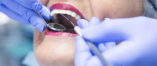 Best Emergency Care for Gum Disease in Piedmont, CA